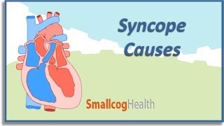 Syncope Causes [upl. by Dacey]